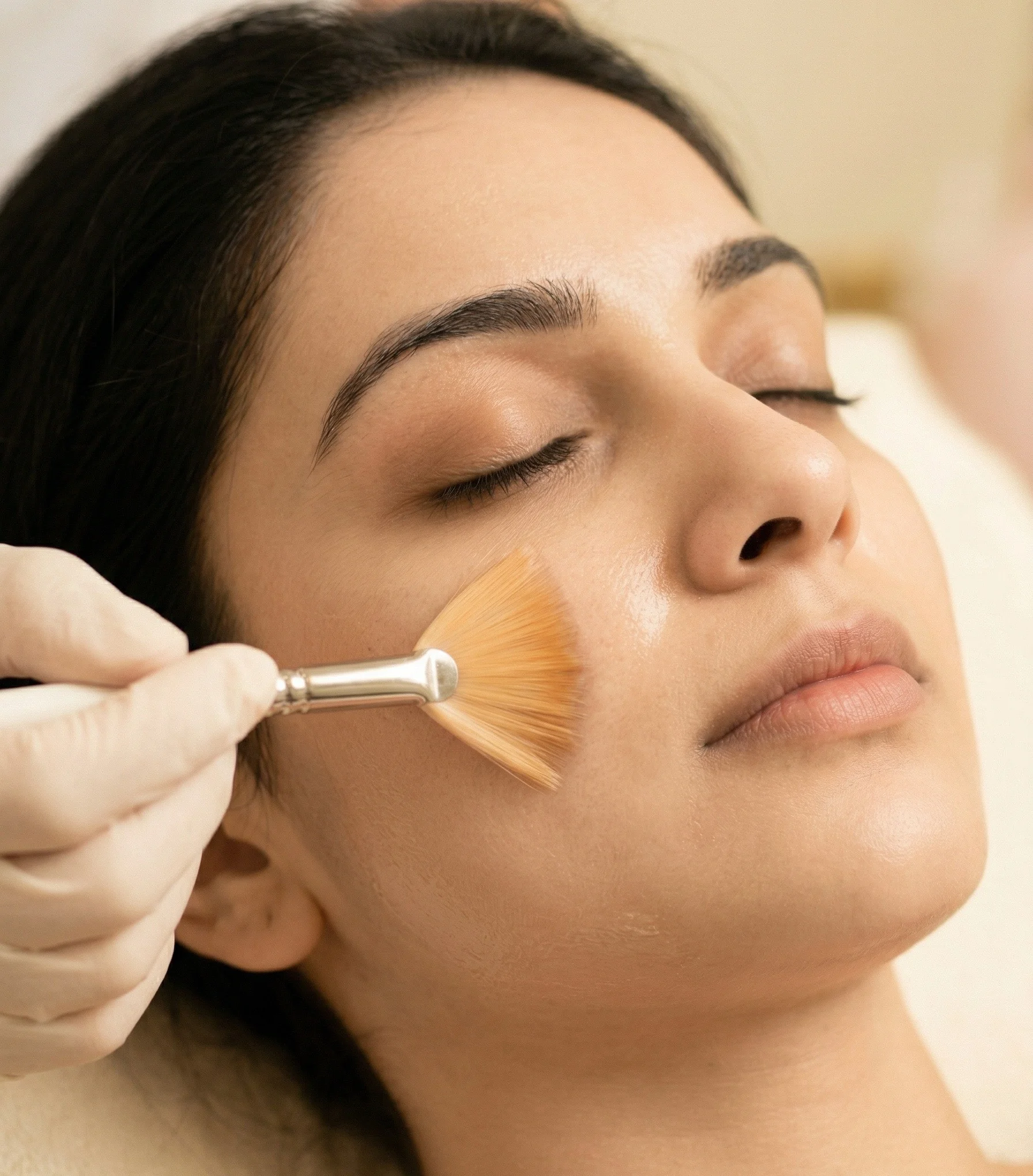 Chemical peel session for skin tone and texture